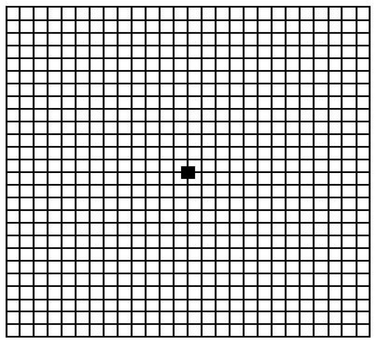 Asmler Grid